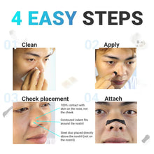 Load image into Gallery viewer, ShopVerse™ - Nasal Breathing Dilators Kit
